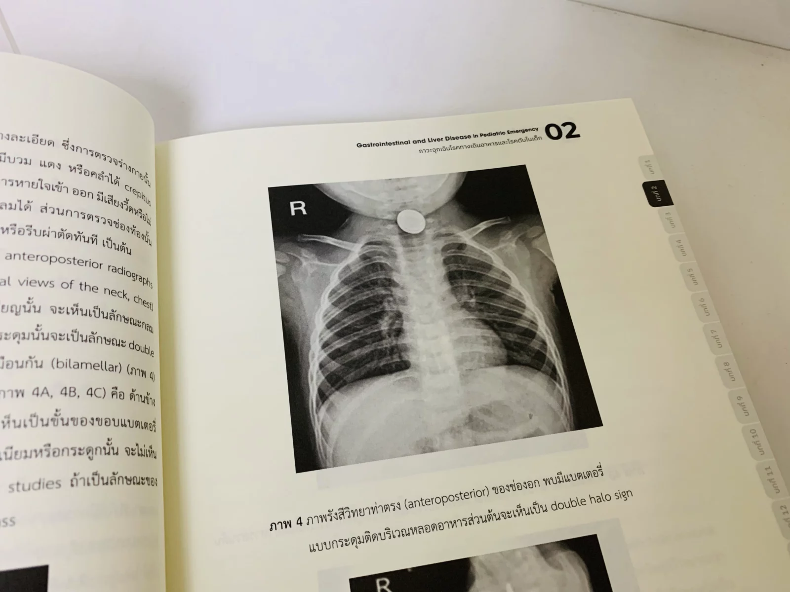 Gastrointestinal