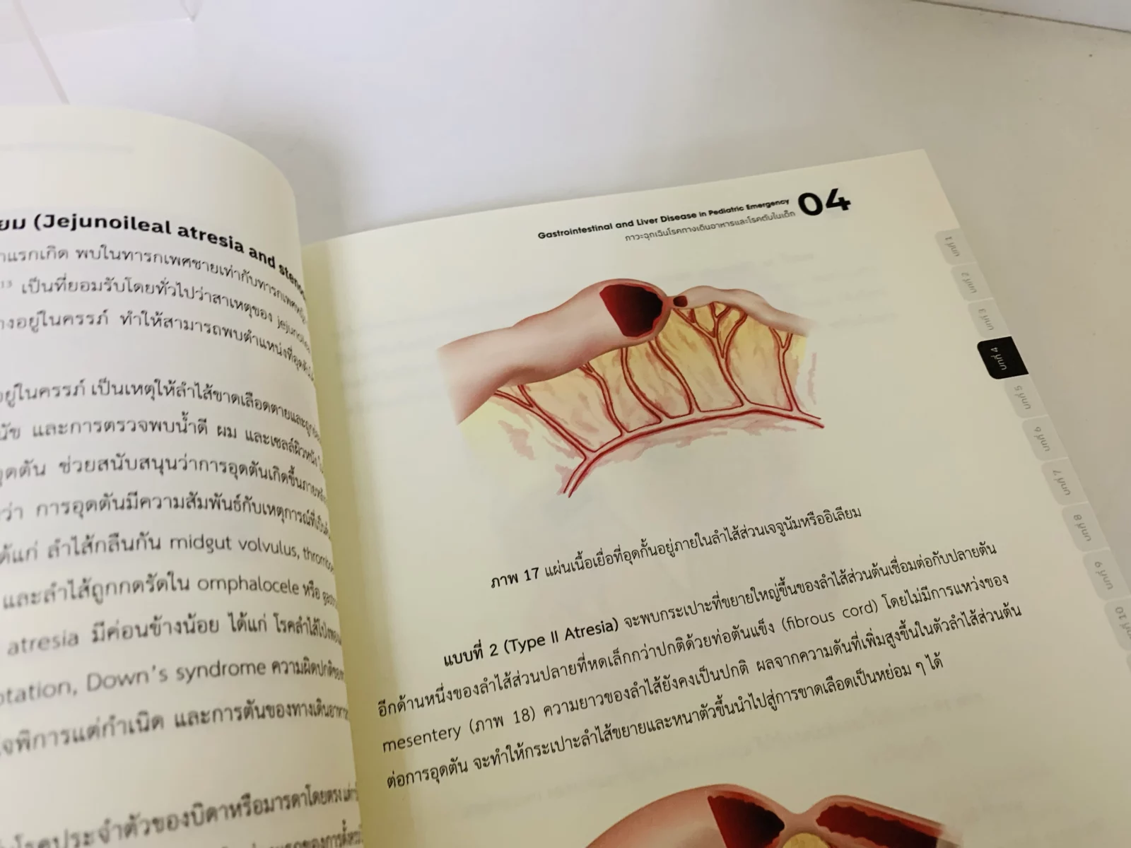 Gastrointestinal