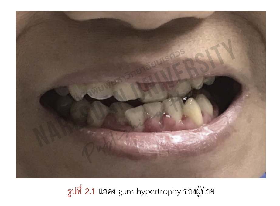 โลหิตวิทยา