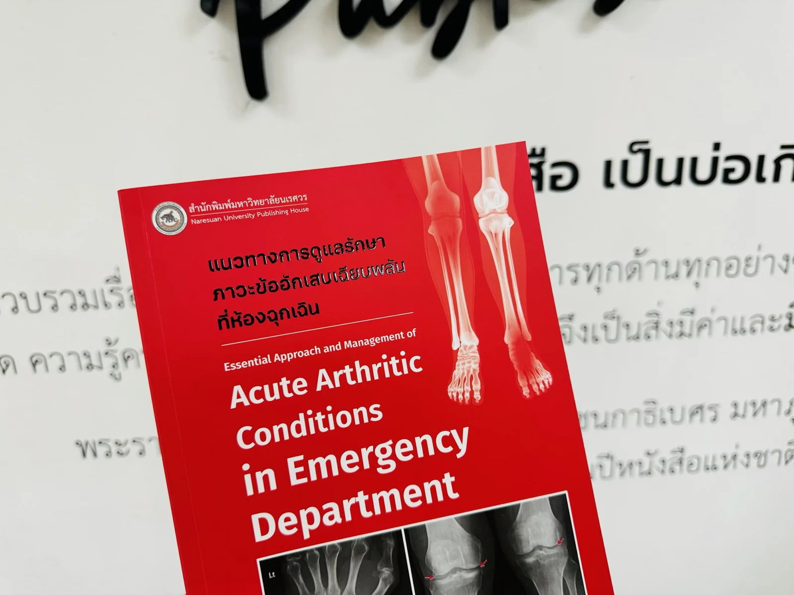 Arthritis