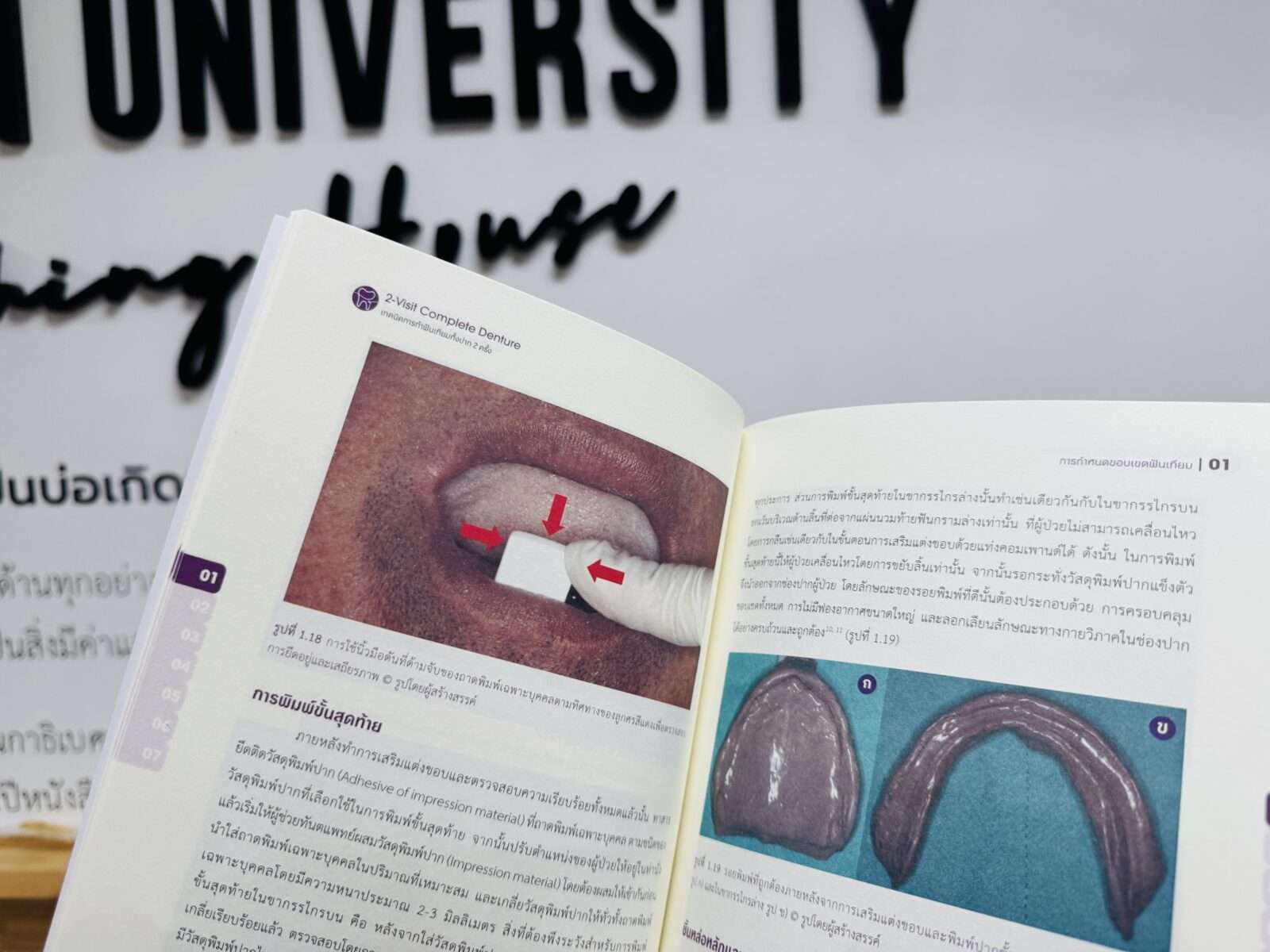 การทำฟันเทียม การทำฟันเทียม