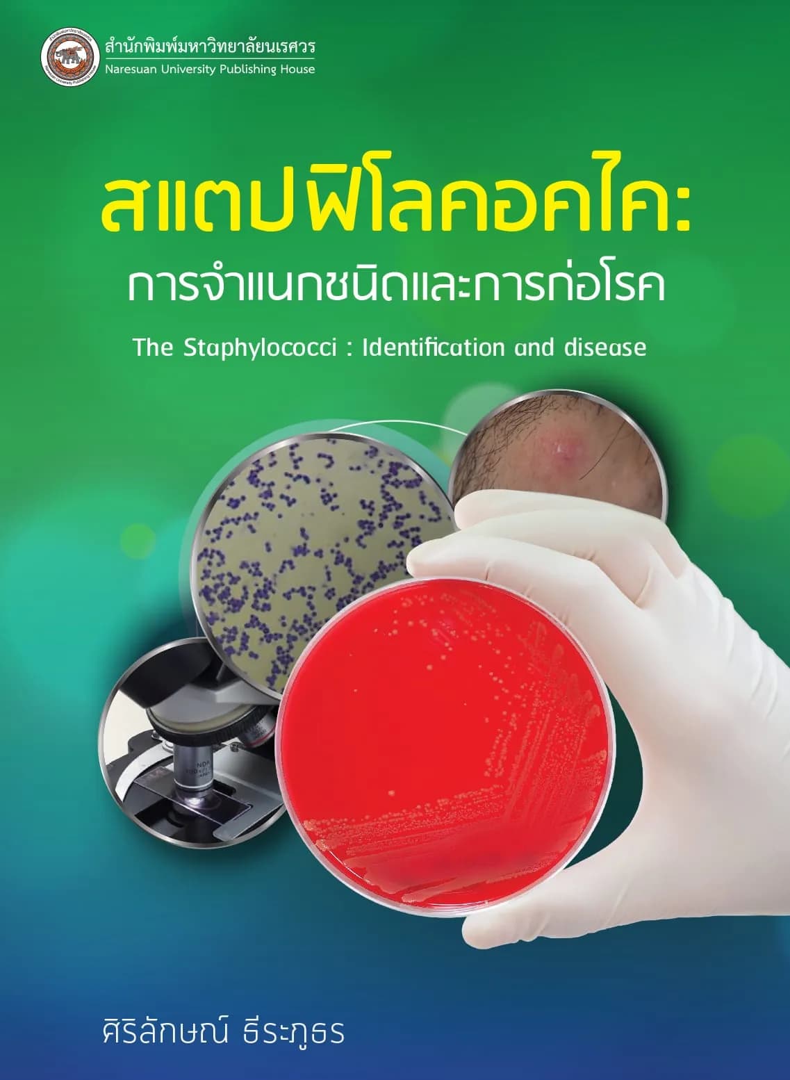 สแตปฟิโลคอคไค: การจำแนกชนิดและการก่อโรค