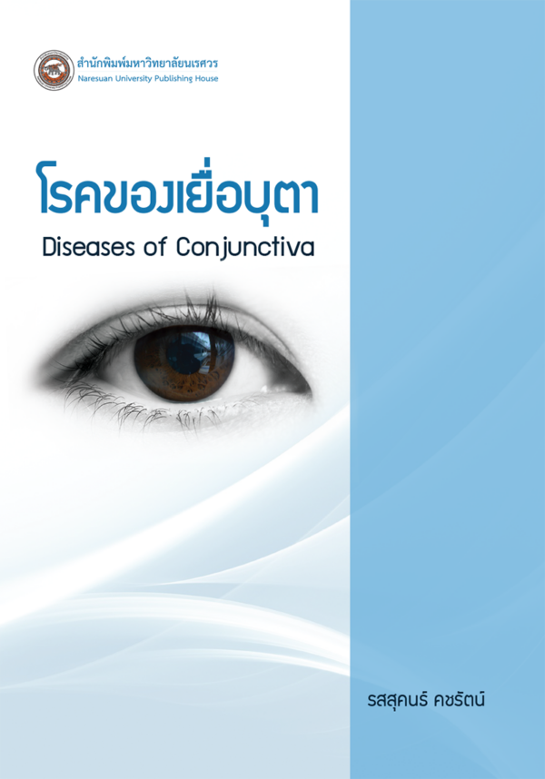 โรคของเยื่อบุตา Diseases of Conjunctiva - Image 2