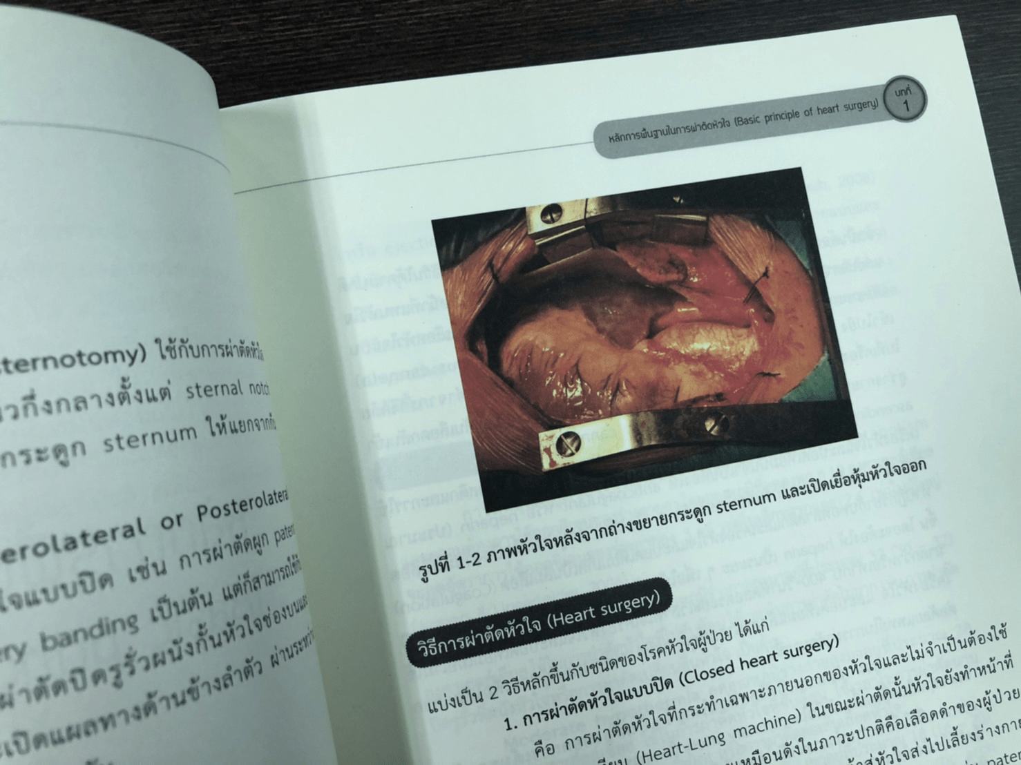 ศัลยศาสตร์โรคหัวใจที่พบบ่อย Common Cardiac surgery
