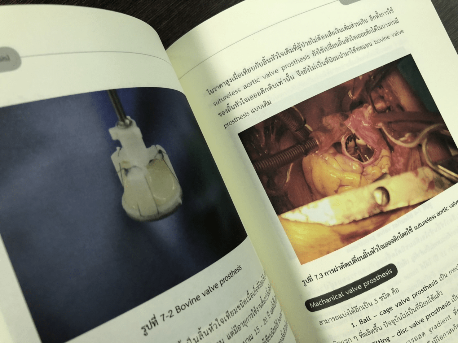 ศัลยศาสตร์โรคหัวใจที่พบบ่อย Common Cardiac surgery
