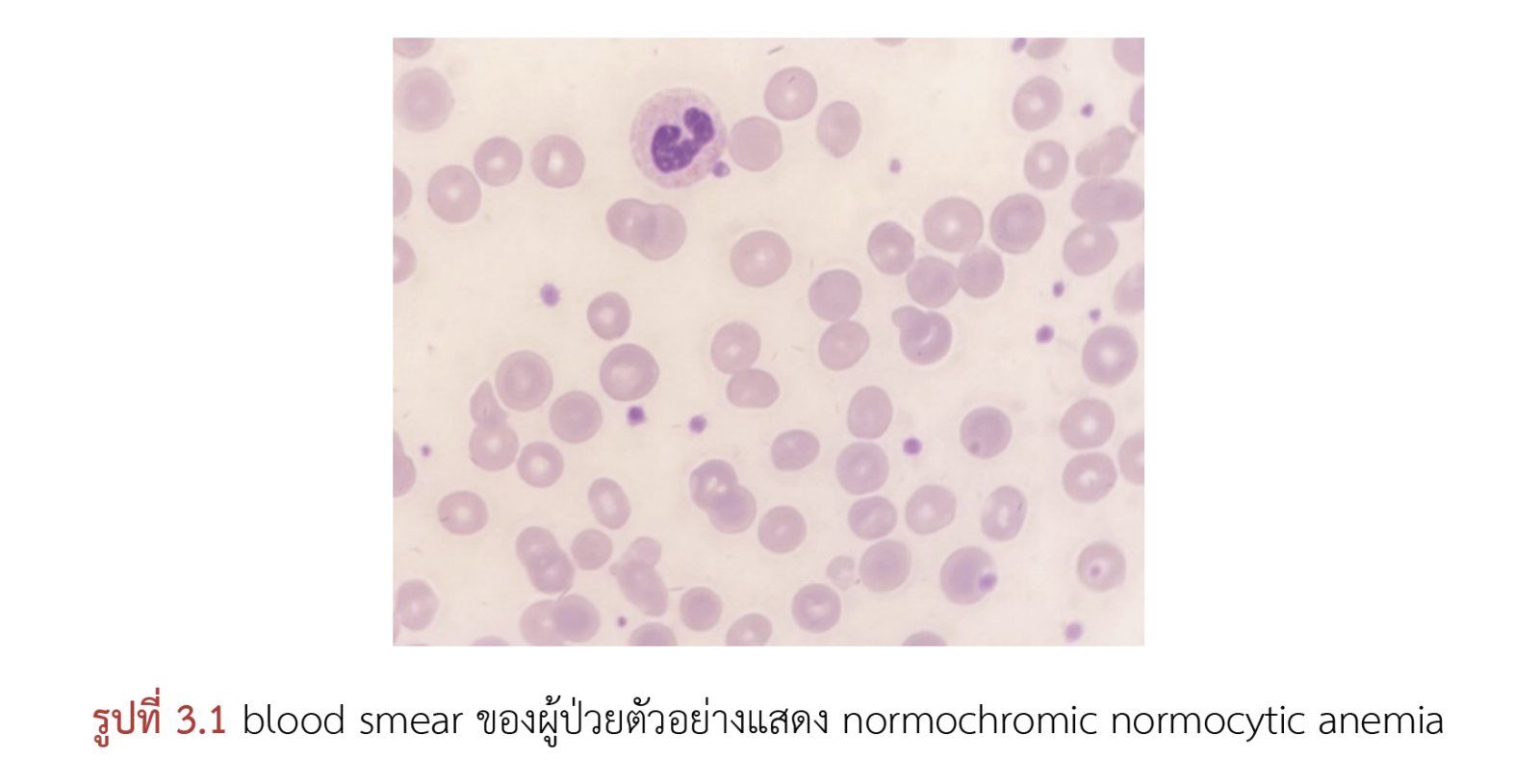 โลหิตวิทยา
